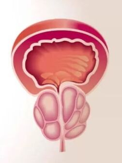 Prostatas iekaisums